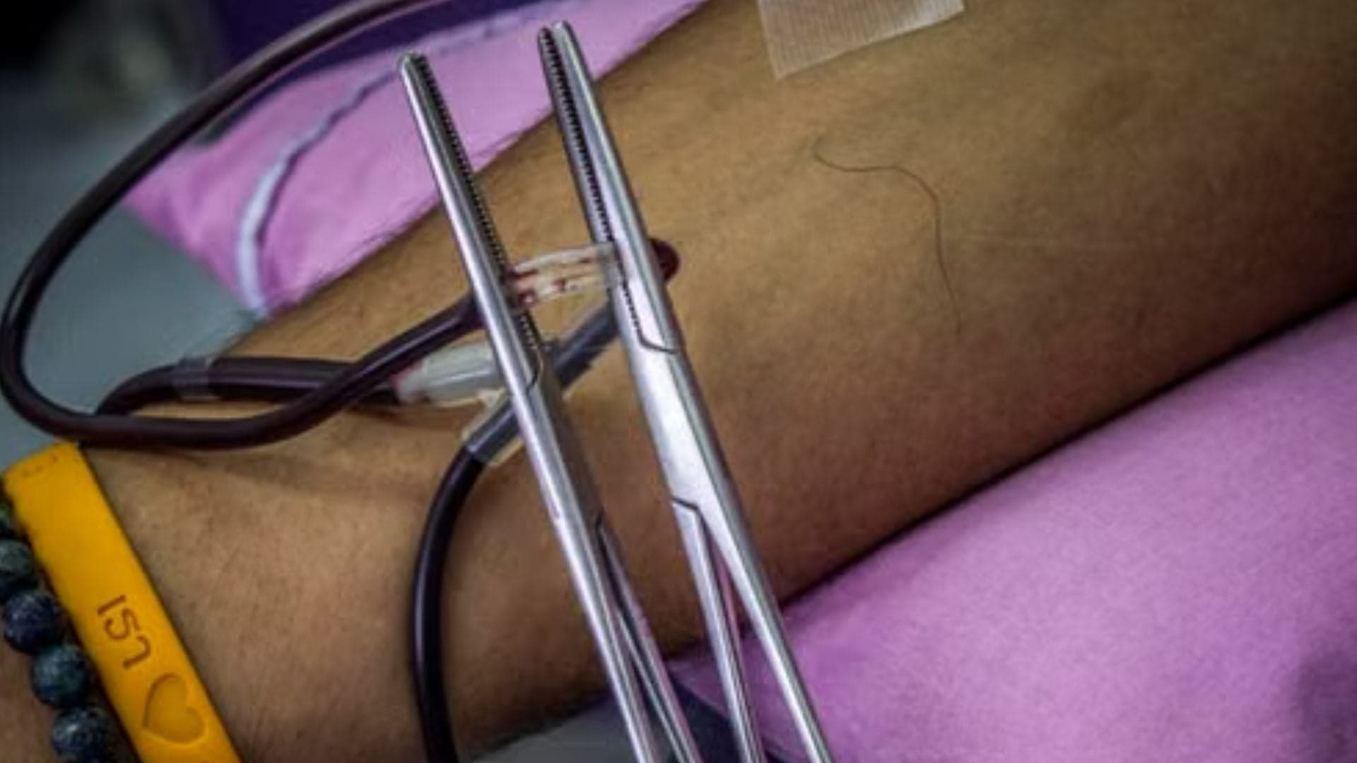 Estudo identifica proteína que pode ajudar no tratamento de linfoma agressivo